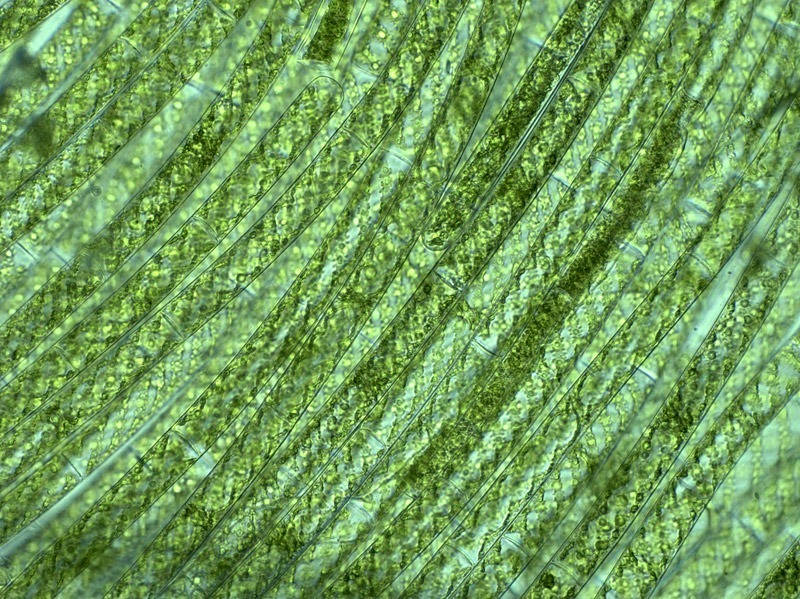 filamentous algae under the microscope